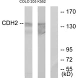 Western Blot - Anti-CDH2 Antibody (C12100) - Antibodies.com
