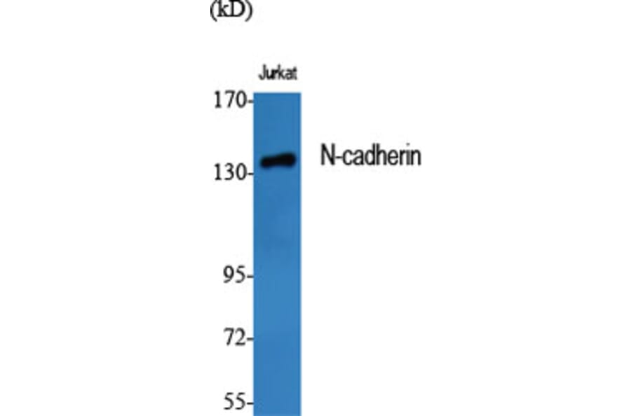 Western Blot - Anti-CDH2 Antibody (C12100) - Antibodies.com