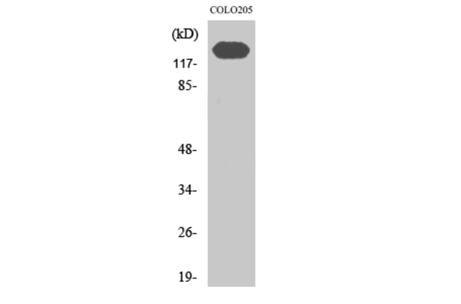 Western Blot - Anti-CDH2 Antibody (C12100) - Antibodies.com