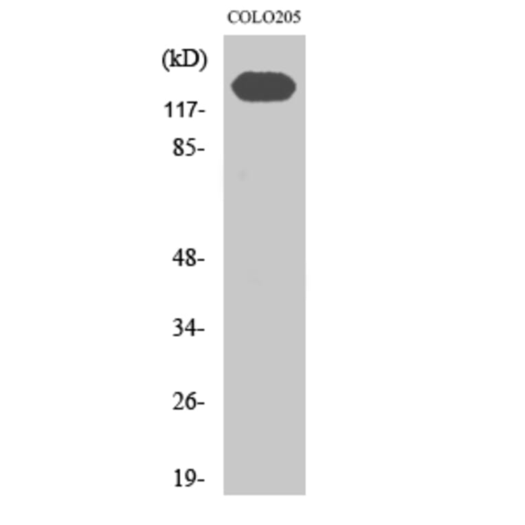 Western Blot - Anti-CDH2 Antibody (C12100) - Antibodies.com