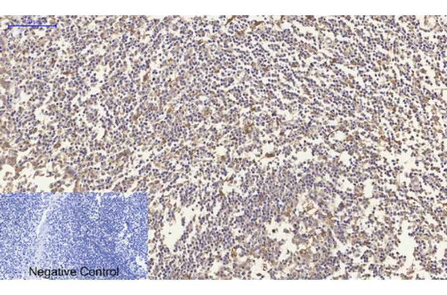 Immunohistochemistry - Anti-CDH2 Antibody (C12100) - Antibodies.com