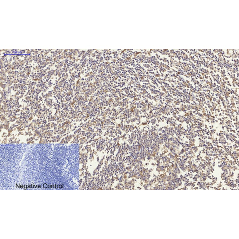 Immunohistochemistry - Anti-CDH2 Antibody (C12100) - Antibodies.com