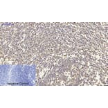 Immunohistochemistry - Anti-CDH2 Antibody (C12100) - Antibodies.com