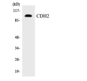 Western Blot - Anti-CDH2 Antibody (R12-2601) - Antibodies.com