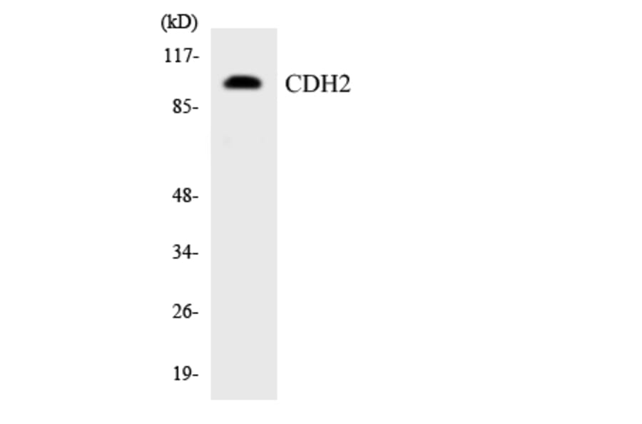 Western Blot - Anti-CDH2 Antibody (R12-2601) - Antibodies.com