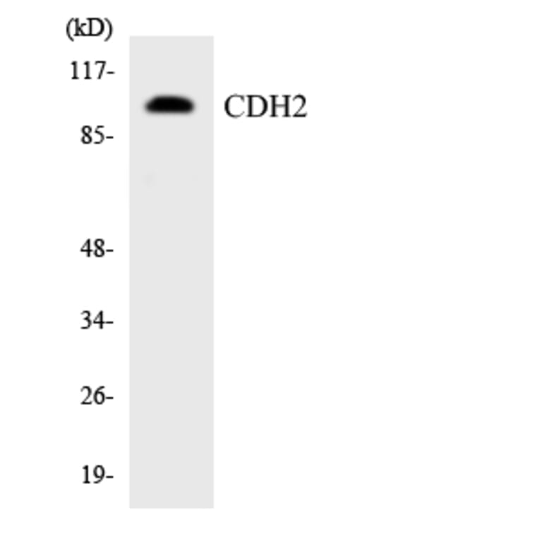 Western Blot - Anti-CDH2 Antibody (R12-2601) - Antibodies.com