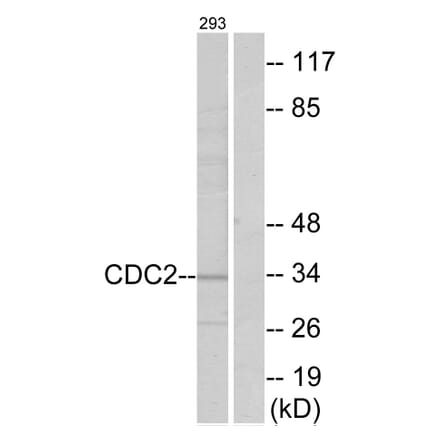 Western Blot - Anti-CDC2 Antibody (B7036) - Antibodies.com