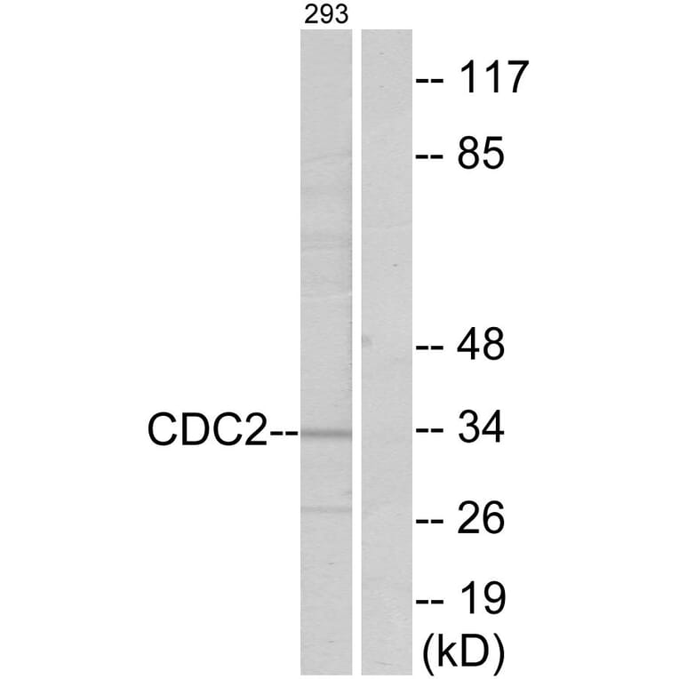 Western Blot - Anti-CDC2 Antibody (B7036) - Antibodies.com