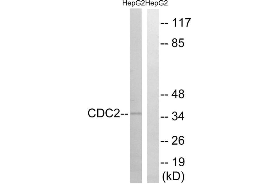 Western Blot - Anti-CDC2 Antibody (B7035) - Antibodies.com