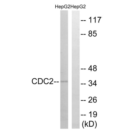 Western Blot - Anti-CDC2 Antibody (B7035) - Antibodies.com