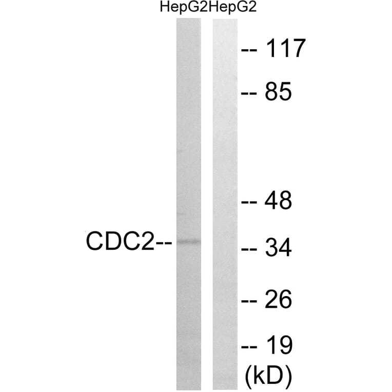 Western Blot - Anti-CDC2 Antibody (B7035) - Antibodies.com