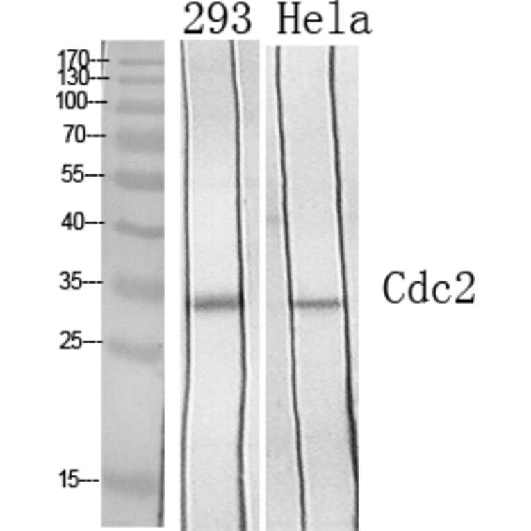 Western Blot - Anti-CDC2 Antibody (B7035) - Antibodies.com