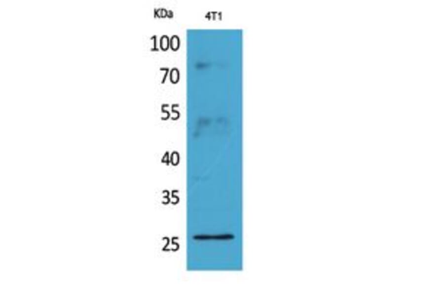 Western Blot - Anti-CD81 Antibody (C30385) - Antibodies.com