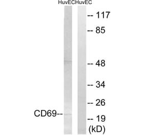 Western Blot - Anti-CD69 Antibody (C15597) - Antibodies.com