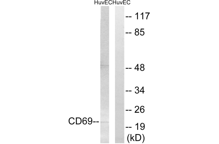 Western Blot - Anti-CD69 Antibody (C15597) - Antibodies.com