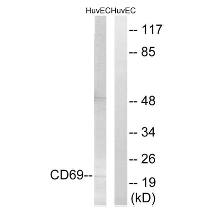 Western Blot - Anti-CD69 Antibody (C15597) - Antibodies.com