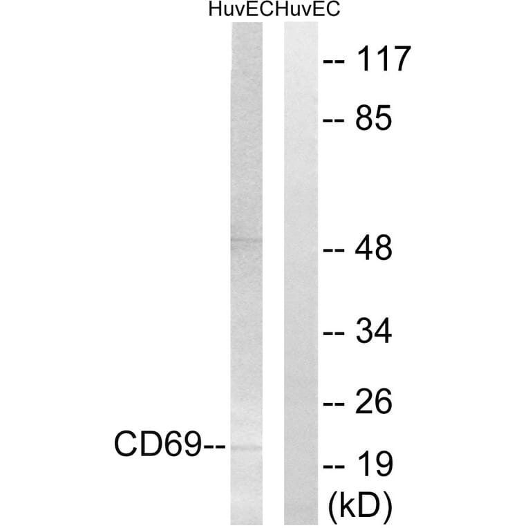 Western Blot - Anti-CD69 Antibody (C15597) - Antibodies.com