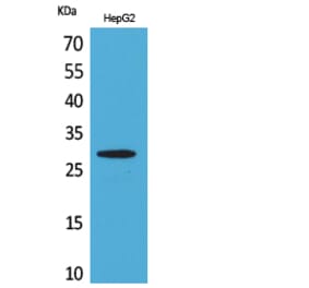 Western Blot - Anti-CD69 Antibody (C30379) - Antibodies.com