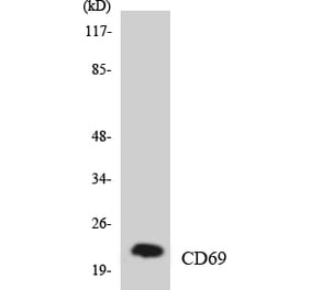 Western Blot - Anti-CD69 Antibody (R12-2591) - Antibodies.com