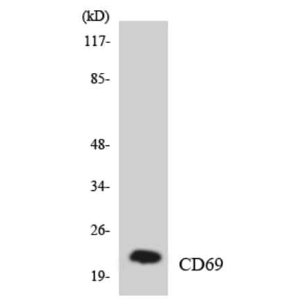 Western Blot - Anti-CD69 Antibody (R12-2591) - Antibodies.com