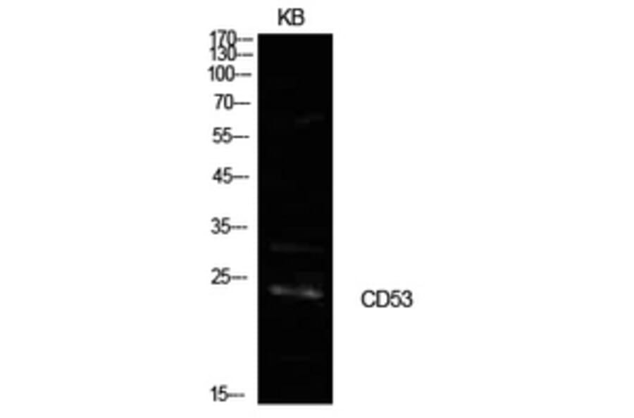 Western Blot - Anti-CD53 Antibody (C30365) - Antibodies.com