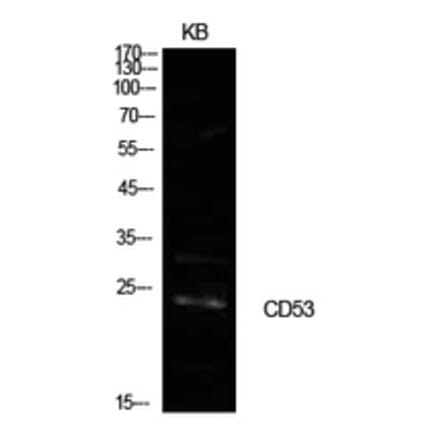 Western Blot - Anti-CD53 Antibody (C30365) - Antibodies.com