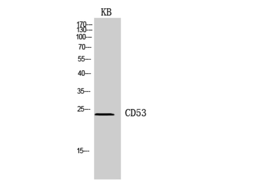 Western Blot - Anti-CD53 Antibody (C30365) - Antibodies.com