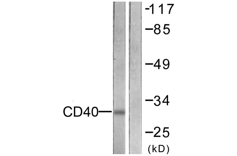 Western Blot - Anti-CD40 Antibody (C0352) - Antibodies.com