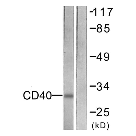 Western Blot - Anti-CD40 Antibody (C0352) - Antibodies.com