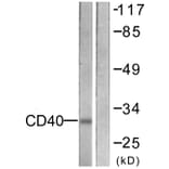 Western Blot - Anti-CD40 Antibody (C0352) - Antibodies.com