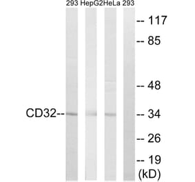 Western Blot - Anti-CD32 Antibody (B0626) - Antibodies.com