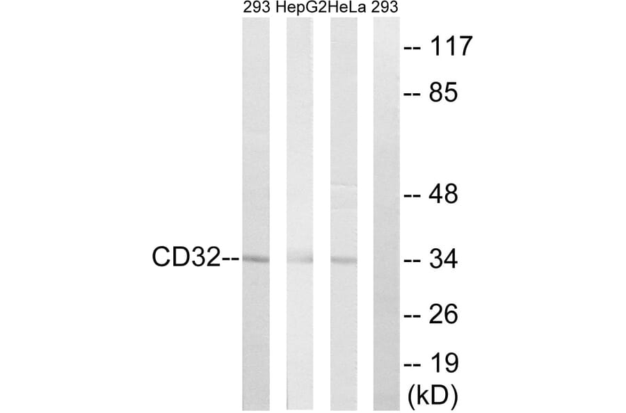 Western Blot - Anti-CD32 Antibody (B0626) - Antibodies.com