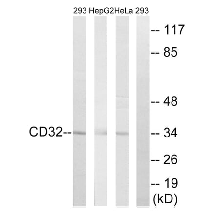 Western Blot - Anti-CD32 Antibody (B0626) - Antibodies.com