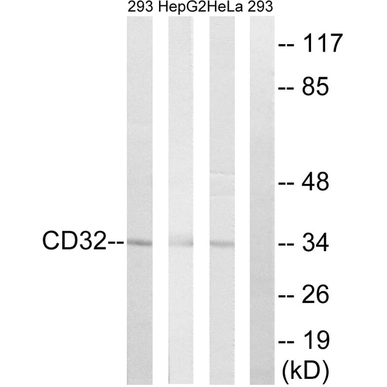Western Blot - Anti-CD32 Antibody (B0626) - Antibodies.com