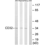 Western Blot - Anti-CD32 Antibody (B0626) - Antibodies.com