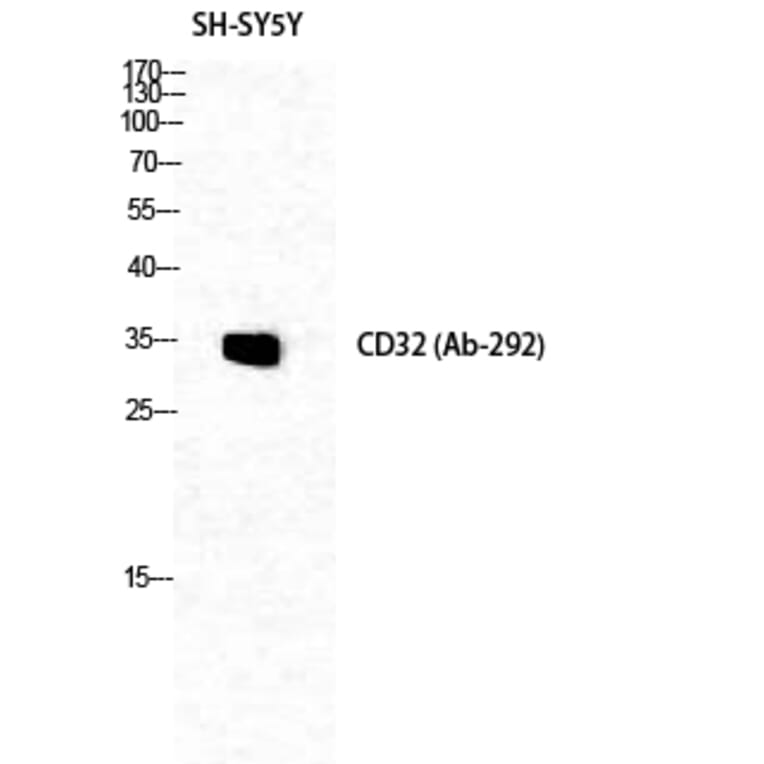 Western Blot - Anti-CD32 Antibody (B0626) - Antibodies.com