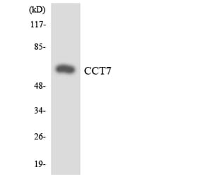 Western Blot - Anti-CCT7 Antibody (R12-2582) - Antibodies.com