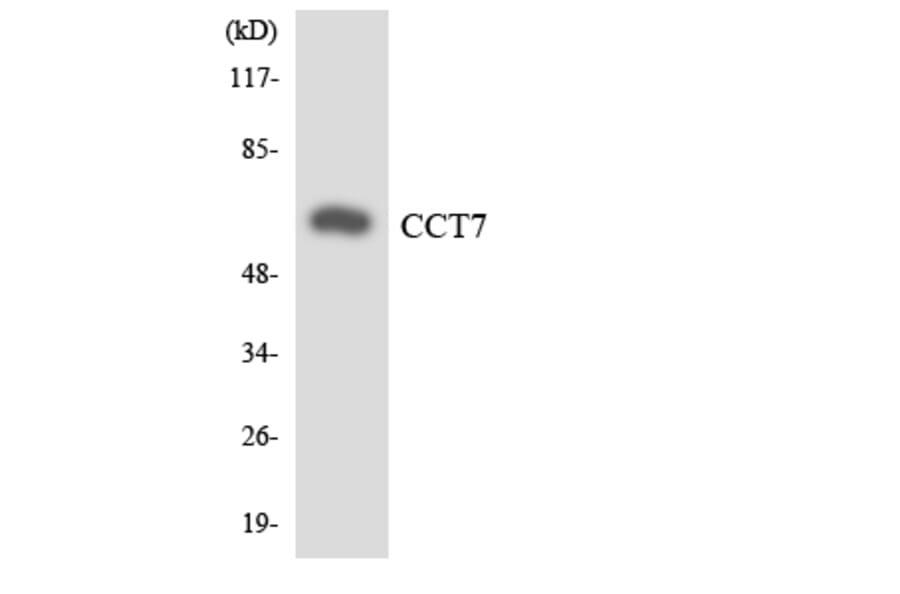 Western Blot - Anti-CCT7 Antibody (R12-2582) - Antibodies.com