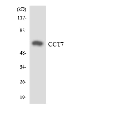 Western Blot - Anti-CCT7 Antibody (R12-2582) - Antibodies.com