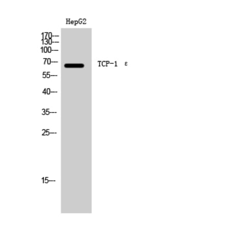 Western Blot - Anti-CCT5 Antibody (C19084) - Antibodies.com
