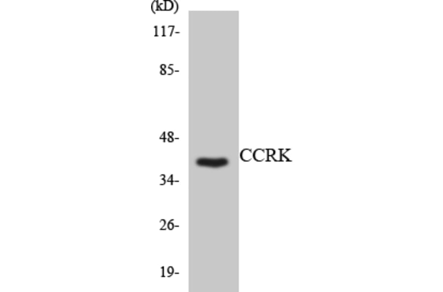 Western Blot - Anti-CCRK Antibody (R12-2579) - Antibodies.com