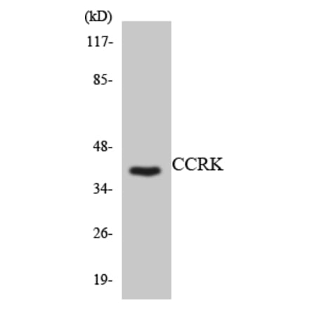 Western Blot - Anti-CCRK Antibody (R12-2579) - Antibodies.com