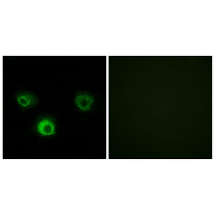 Immunofluorescence - Anti-CCR4 Antibody (C12128) - Antibodies.com