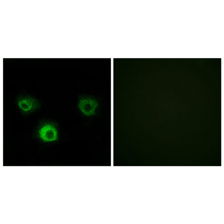 Immunofluorescence - Anti-CCR4 Antibody (C12128) - Antibodies.com