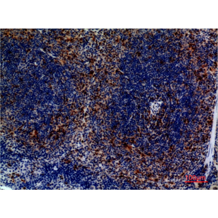 Immunohistochemistry - Anti-CCR4 Antibody (C30582) - Antibodies.com