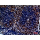 Immunohistochemistry - Anti-CCR4 Antibody (C30582) - Antibodies.com