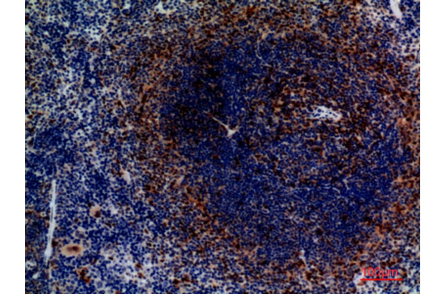 Immunohistochemistry - Anti-CCR4 Antibody (C30582) - Antibodies.com