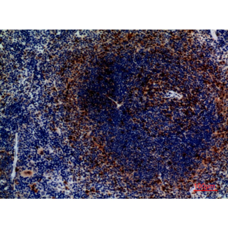 Immunohistochemistry - Anti-CCR4 Antibody (C30582) - Antibodies.com