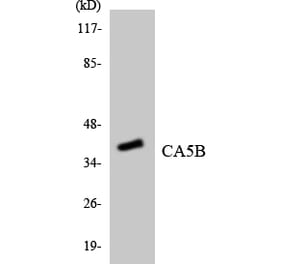 Western Blot - Anti-CA5B Antibody (R12-2558) - Antibodies.com