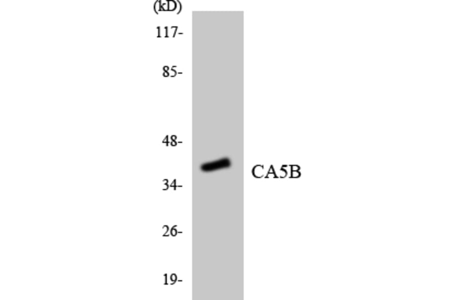Western Blot - Anti-CA5B Antibody (R12-2558) - Antibodies.com